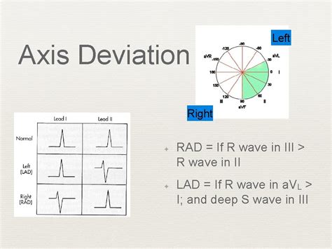 Axial Deviation Tester|axis deviation ecg interpretation.